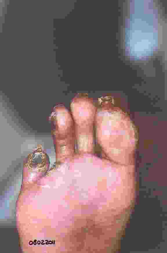 04_g_4_15kb